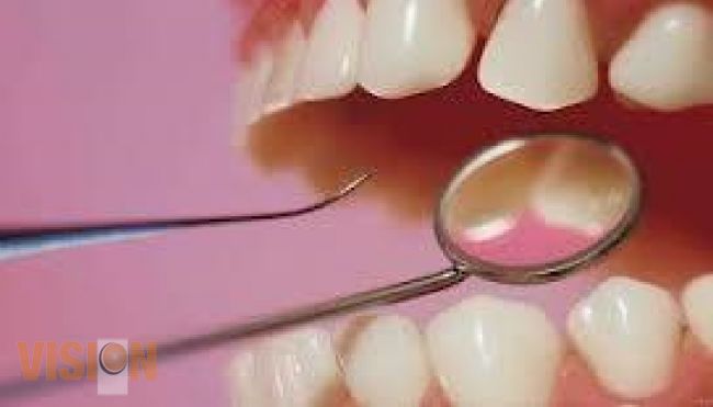 Capacita SSM a personal odontológico sobre materiales preventivos.