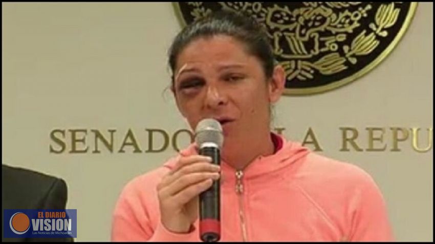 Agresión en mi contra fue cobarde e imperdonable: Ana Gabriela Guevara