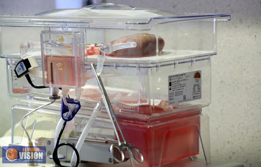 Seguro Social conserva riñones hasta por 67 horas gracias a máquina de Perfusión Pulsátil